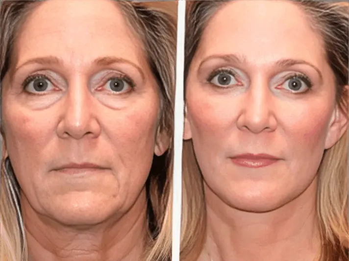 Olavita Liquid Solution customer review Michelle B.