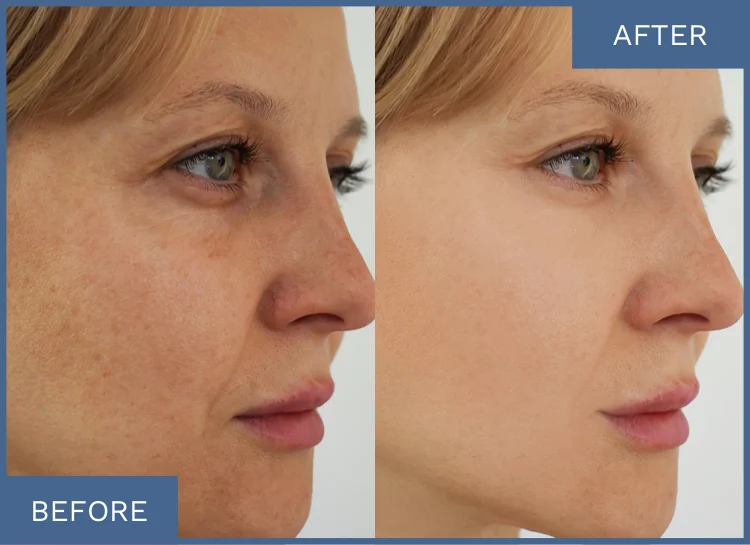 How to use Olavita Liquid Solution